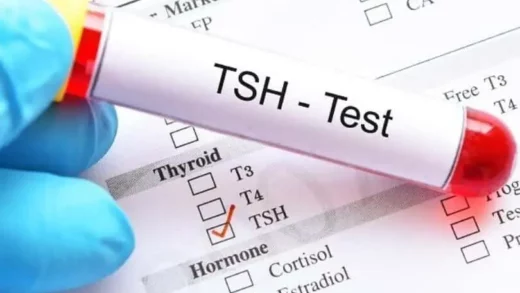 TSH Test