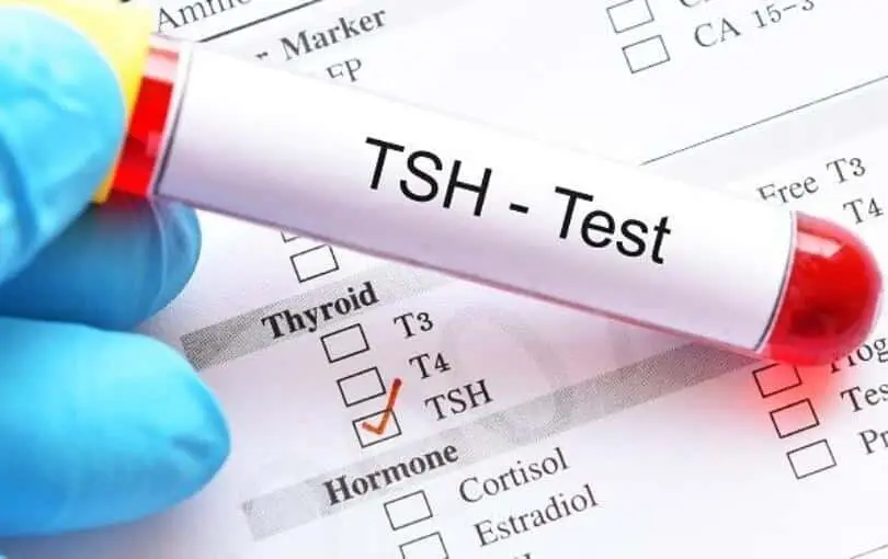 TSH Test