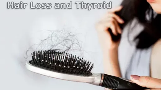 Thyroid and Hair Loss